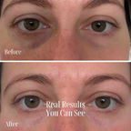 Vital Eye Pro  – Under-Eye Treatment for Puffiness & Bags